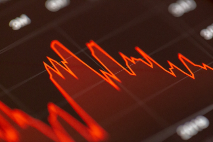 Market Meltdown: Understanding the Factors Behind the Recent Stock Market Crash
